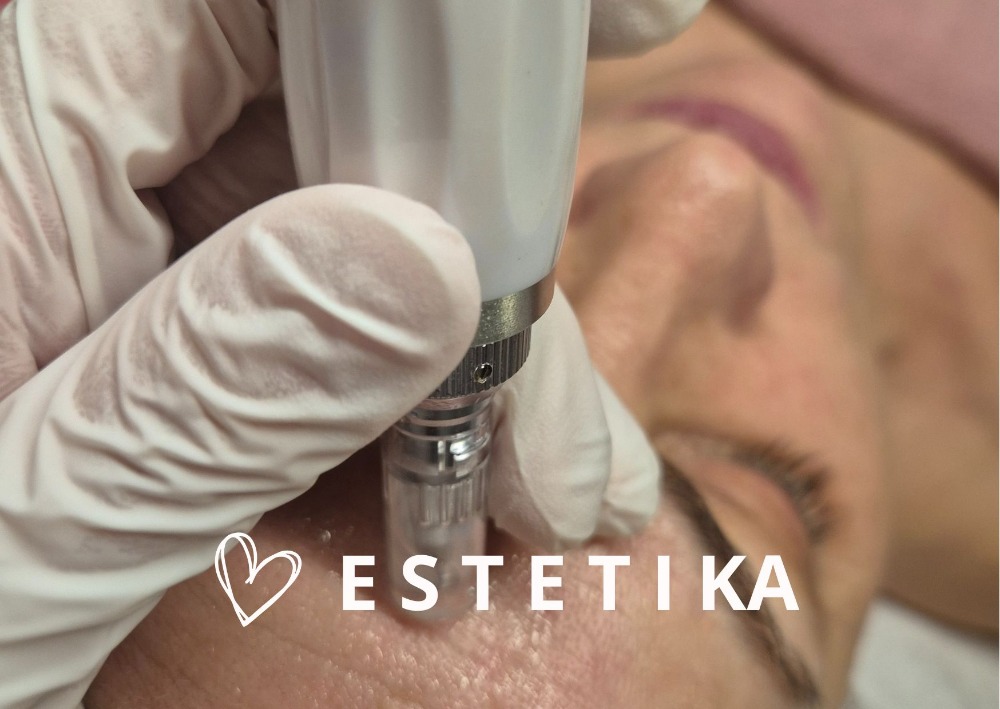 Fotka o estetice, majitelka provádí ošetčení